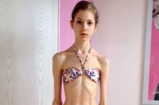 best of Mirror anorexic check
