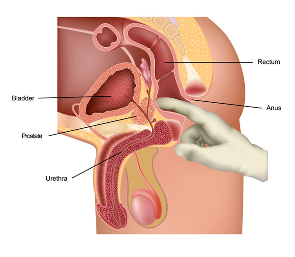 Masturbation techniques stimulation anus prostate gland