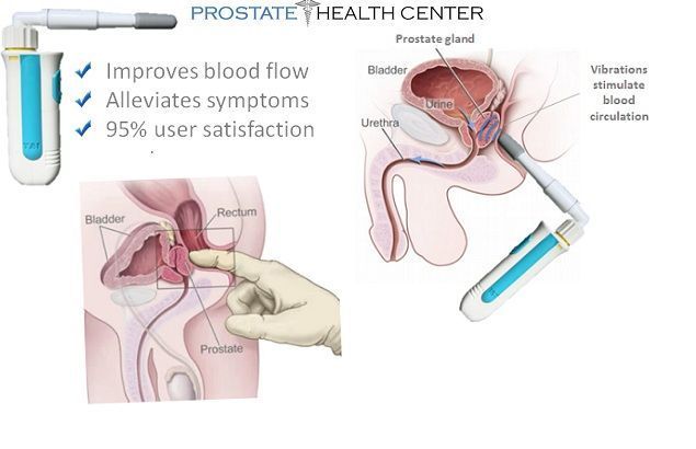 best of Prostate gland masturbation stimulation techniques anus