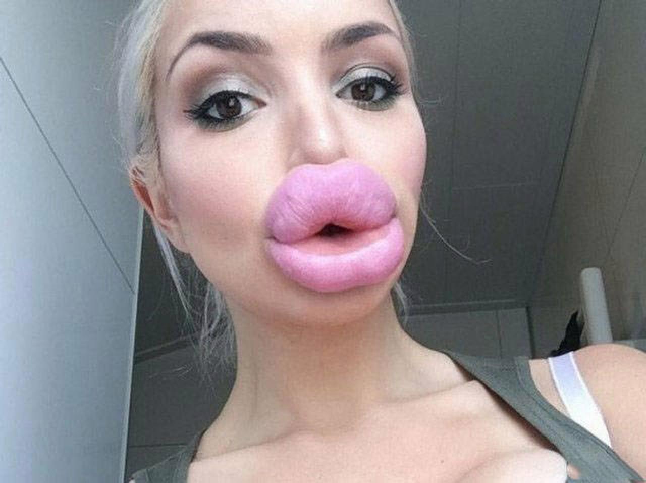 Dingo reccomend giant lips
